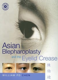 Asian Blepharoplasty and the Eyelid Crease with DVD